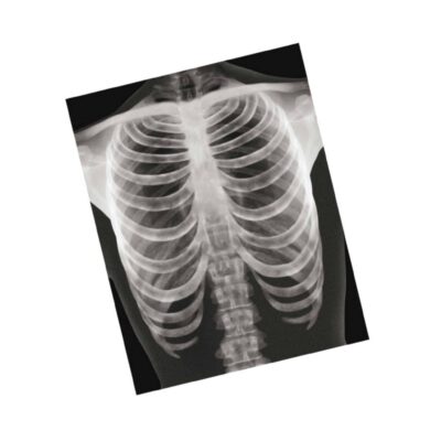 Röntgenbilder Mensch